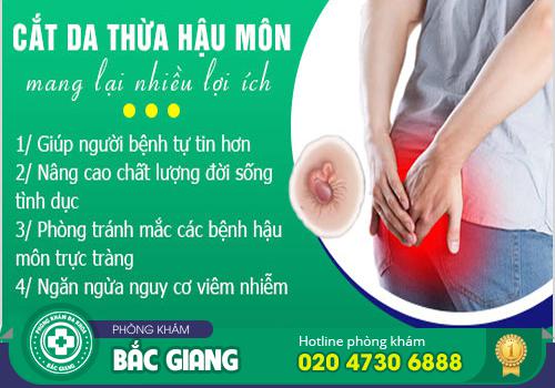 Có nên cắt da thừa hậu môn không?